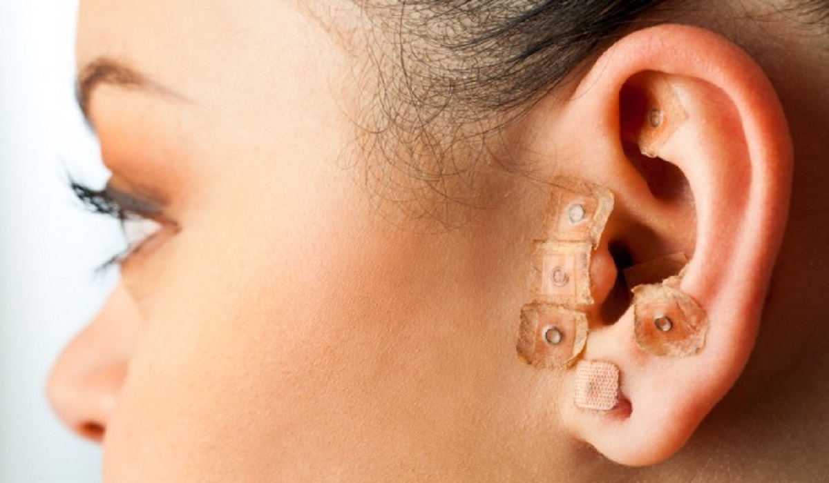 auricoloterapia auricoloterapia